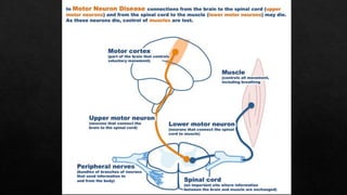 Motor neuron disease - understanding the brain | PDF