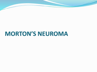 MORTON’S NEUROMA
 
