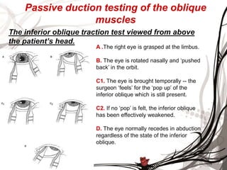 Motor physiology of the eye | PPTX