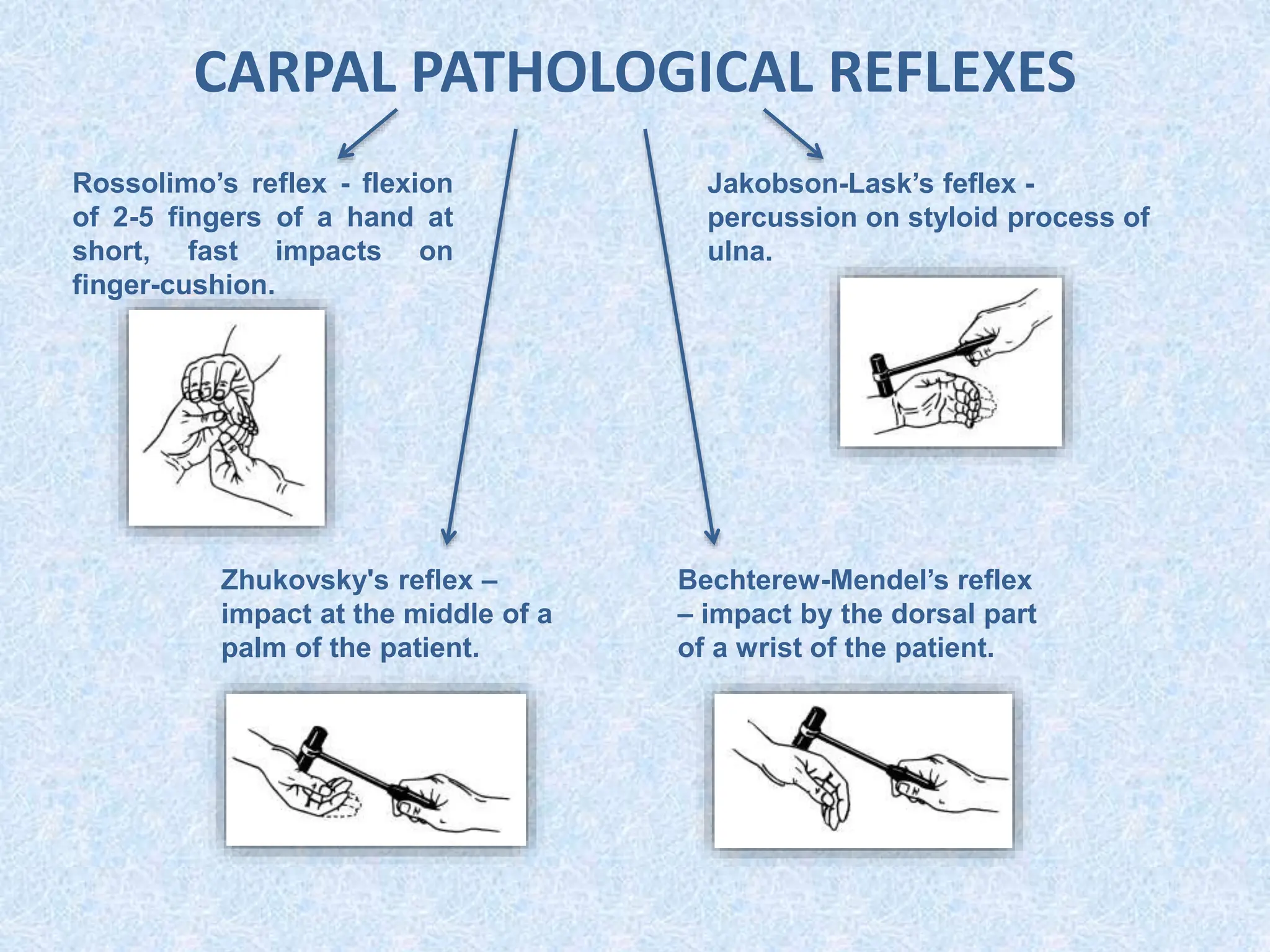 CARPAL PATHOLOGICAL REFLEXES
Rossolimo’s reflex - flexion
of 2-5 fingers of a hand at
short, fast impacts on
finger-cushion.
Zhukovsky's reflex –
impact at the middle of a
palm of the patient.
Bechterew-Mendel’s reflex
– impact by the dorsal part
of a wrist of the patient.
Jakobson-Lask’s feflex -
percussion on styloid process of
ulna.
 