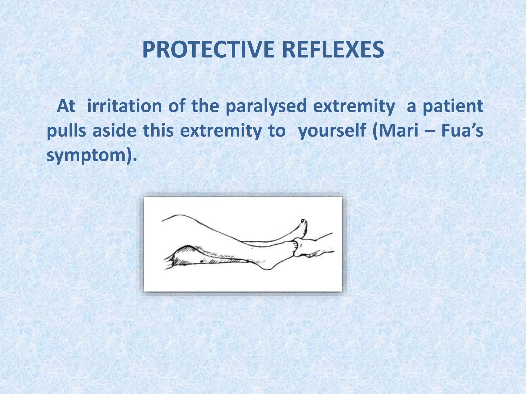 PROTECTIVE REFLEXES
At irritation of the paralysed extremity a patient
pulls aside this extremity to yourself (Mari – Fua’s
symptom).
 