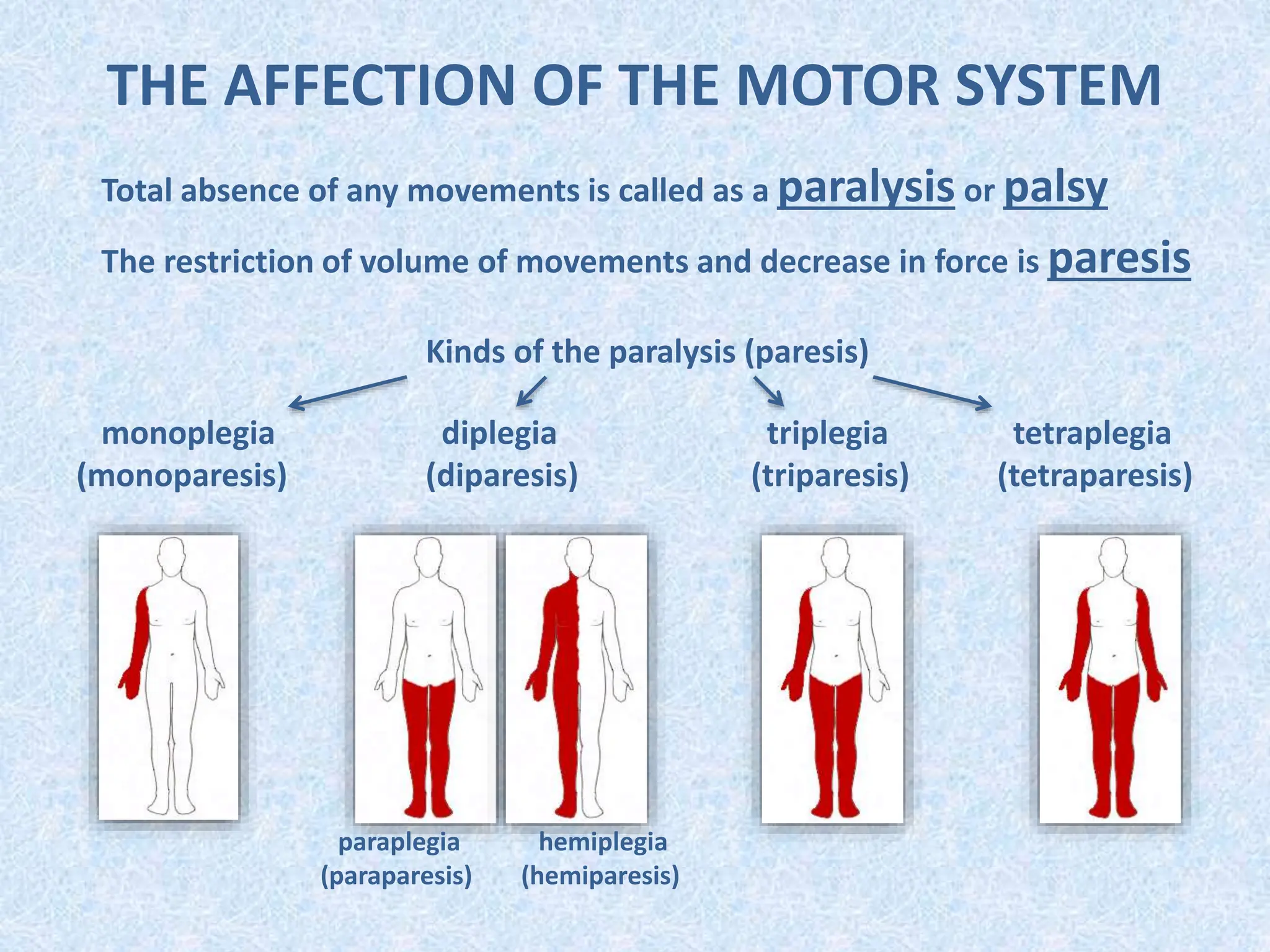 THE AFFECTION OF THE MOTOR SYSTEM
Total absence of any movements is called as a paralysis or palsy
The restriction of volume of movements and decrease in force is paresis
Kinds of the paralysis (paresis)
monoplegia diplegia triplegia tetraplegia
(monoparesis) (diparesis) (triparesis) (tetraparesis)
paraplegia
(paraparesis)
hemiplegia
(hemiparesis)
 