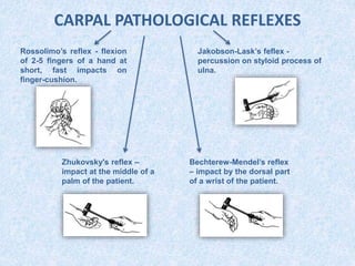 CARPAL PATHOLOGICAL REFLEXES
Rossolimo’s reflex - flexion
of 2-5 fingers of a hand at
short, fast impacts on
finger-cushion.
Zhukovsky's reflex –
impact at the middle of a
palm of the patient.
Bechterew-Mendel’s reflex
– impact by the dorsal part
of a wrist of the patient.
Jakobson-Lask’s feflex -
percussion on styloid process of
ulna.
 