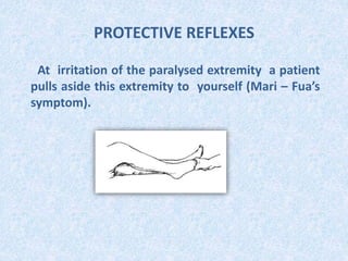 PROTECTIVE REFLEXES
At irritation of the paralysed extremity a patient
pulls aside this extremity to yourself (Mari – Fua’s
symptom).
 