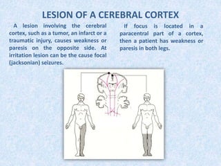 LESION OF A CEREBRAL CORTEX
A lesion involving the cerebral
cortex, such as a tumor, an infarct or a
traumatic injury, causes weakness or
paresis on the opposite side. At
irritation lesion can be the cause focal
(jacksonian) seizures.
If focus is located in a
paracentral part of a cortex,
then a patient has weakness or
paresis in both legs.
 