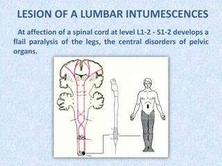 LESION OF A LUMBAR INTUMESCENCES
At affection of a spinal cord at level L1-2 - S1-2 develops a
flail paralysis of the legs, the central disorders of pelvic
organs.
 