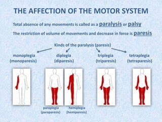 THE AFFECTION OF THE MOTOR SYSTEM
Total absence of any movements is called as a paralysis or palsy
The restriction of volume of movements and decrease in force is paresis
Kinds of the paralysis (paresis)
monoplegia diplegia triplegia tetraplegia
(monoparesis) (diparesis) (triparesis) (tetraparesis)
paraplegia
(paraparesis)
hemiplegia
(hemiparesis)
 