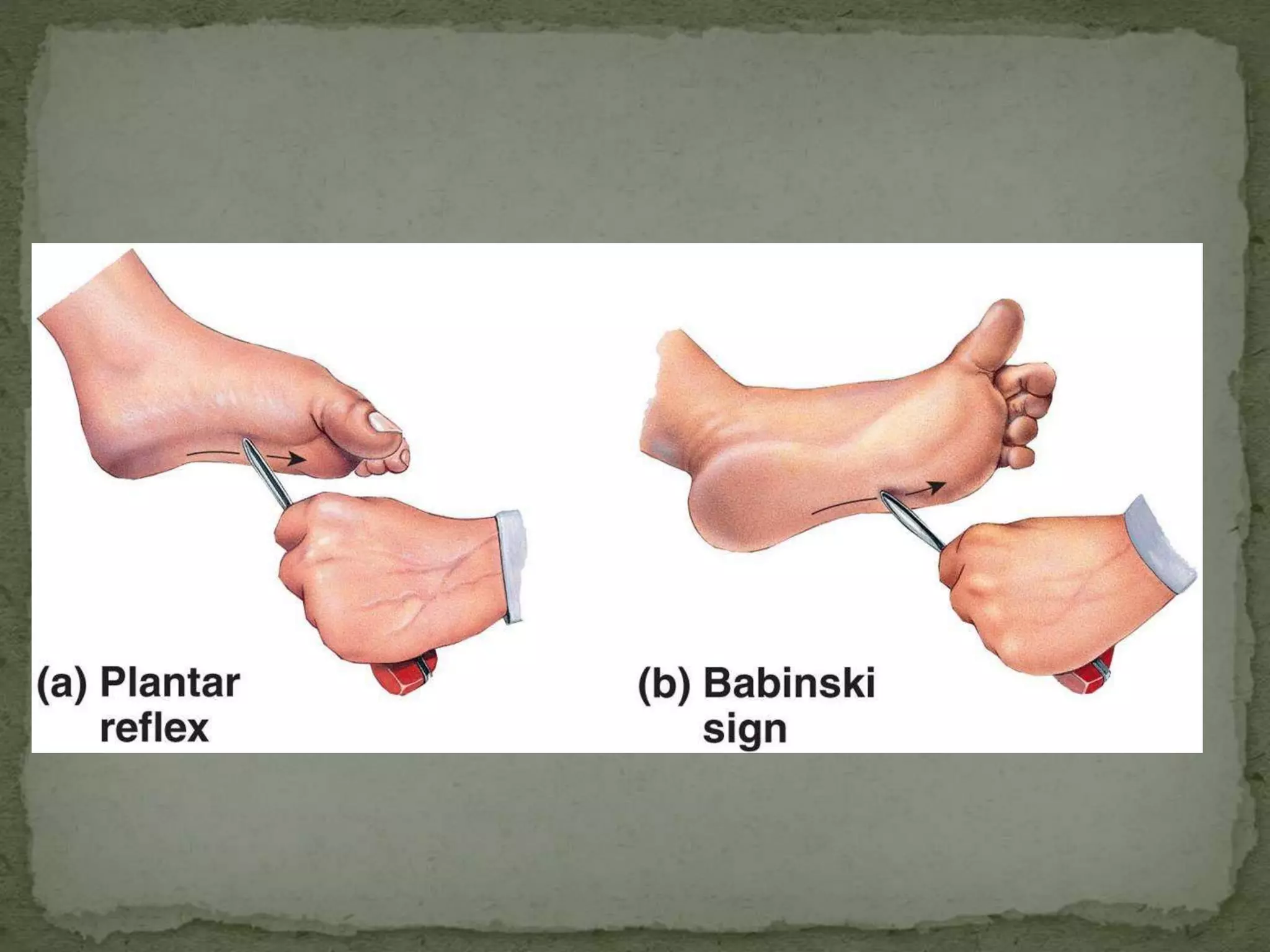 Motor tracts of brain and spinal cord