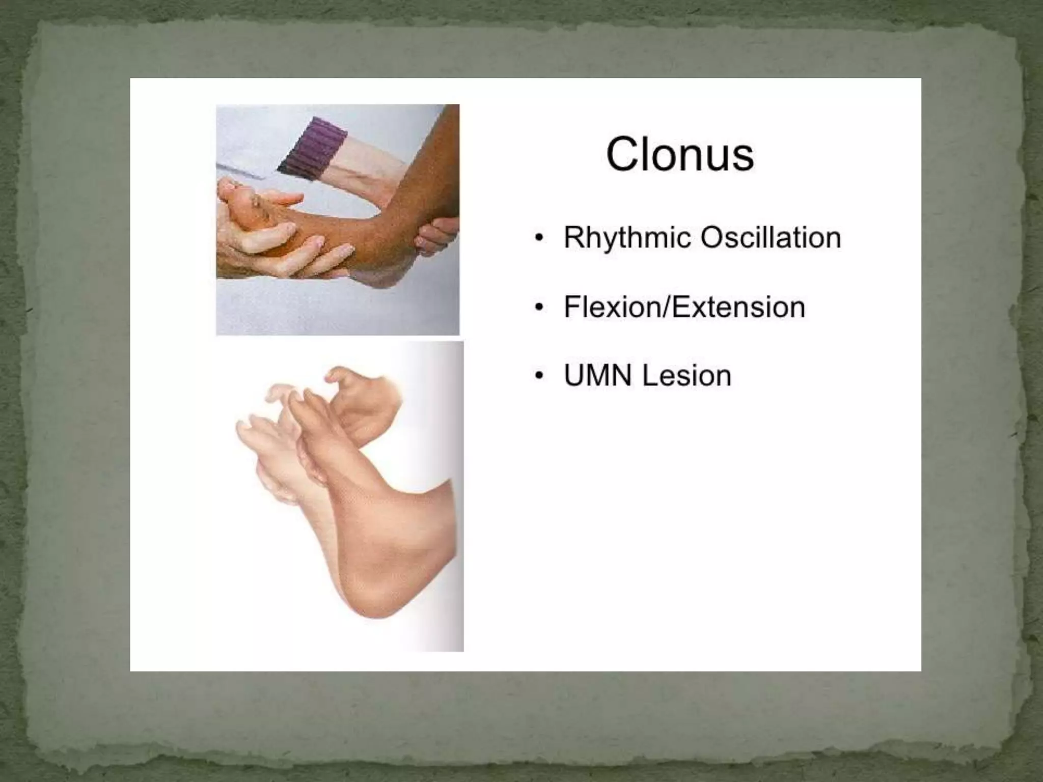 Motor tracts of brain and spinal cord