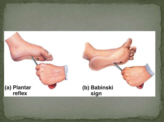 Motor tracts of brain and spinal cord | PPTX | Brain and Nervous System ...
