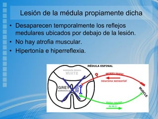 Lesión de la médula propiamente dicha
• Desaparecen temporalmente los reflejos
medulares ubicados por debajo de la lesión.
• No hay atrofia muscular.
• Hipertonía e hiperreflexia.
 