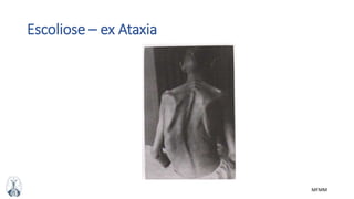 MFMM
Escoliose – ex Ataxia
 