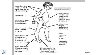 MFMM
Marcha hanserina
 