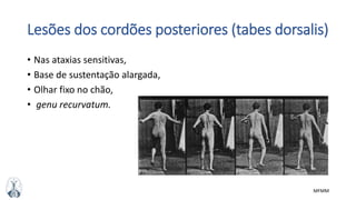 MFMM
Lesões dos cordões posteriores (tabes dorsalis)
• Nas ataxias sensitivas,
• Base de sustentação alargada,
• Olhar fixo no chão,
• genu recurvatum.
 