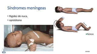 MFMM
Síndromes meníngeas
• Rigidez de nuca,
• opistótono
 