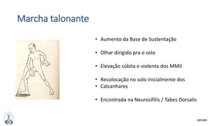MFMM
Marcha talonante
• Aumento da Base de Sustentação
• Olhar dirigido pra o solo
• Elevação súbita e violenta dos MMII
• Recolocação no solo inicialmente dos
• Calcanhares
• Encontrada na Neurosífilis / Tabes Dorsalis
 