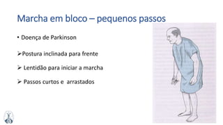 MFMM
Marcha em bloco – pequenos passos
• Doença de Parkinson
Postura inclinada para frente
 Lentidão para iniciar a marcha
 Passos curtos e arrastados
 