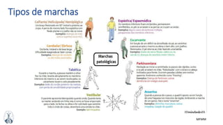 MFMM
Tipos de marchas
 
