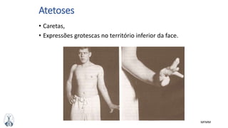 MFMM
Atetoses
• Caretas,
• Expressões grotescas no território inferior da face.
 