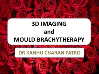 3D IMAGING
and
MOULD BRACHYTHERAPY
DR KANHU CHARAN PATRO
 