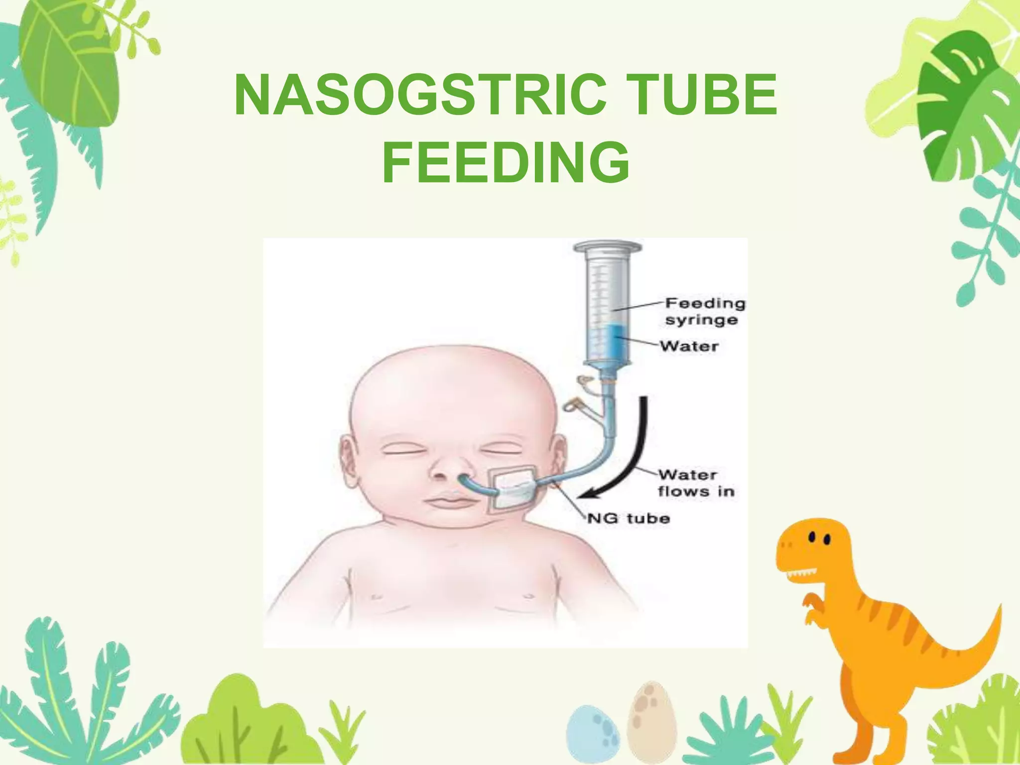 NASOGSTRIC TUBE
FEEDING
 