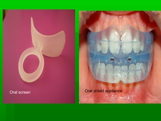 Oral screen Oral shield appliance
 