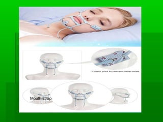 Mouth strap
 