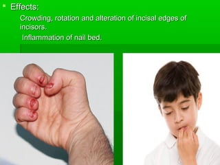  Effects:Effects:
 Crowding, rotation and alteration of incisal edges ofCrowding, rotation and alteration of incisal edges of
incisors.incisors.
 Inflammation of nail bed.Inflammation of nail bed.
 