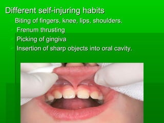 Different self-injuring habitsDifferent self-injuring habits
Biting of fingers, knee, lips, shoulders.Biting of fingers, knee, lips, shoulders.
 Frenum thrustingFrenum thrusting
 Picking of gingivaPicking of gingiva
 Insertion of sharp objects into oral cavity.Insertion of sharp objects into oral cavity.
 