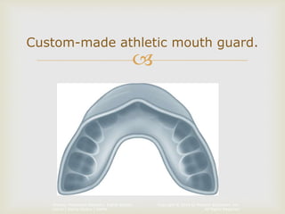 Copyright © 2014 by Pearson Education, Inc.
All Rights Reserved
Primary Preventive Dentistry, Eighth Edition
Harris | Garcia-Godoy | Nathe

Custom-made athletic mouth guard.
 
