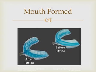 Copyright © 2014 by Pearson Education, Inc.
All Rights Reserved
Primary Preventive Dentistry, Eighth Edition
Harris | Garcia-Godoy | Nathe

Mouth Formed
 