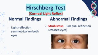 Hirschberg Test Normal Comprehensive Assessment of Mouth, Nose, Throat, Sinus, and Eye Health ...
