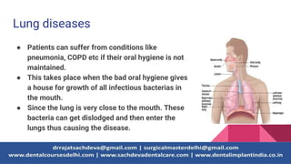 Lung diseases
● Patients can suffer from conditions like
pneumonia, COPD etc if their oral hygiene is not
maintained.
● This takes place when the bad oral hygiene gives
a house for growth of all infectious bacterias in
the mouth.
● Since the lung is very close to the mouth. These
bacteria can get dislodged and then enter the
lungs thus causing the disease.
 