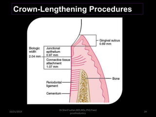 10/21/2019
Dr.Sherif sultan,BDS,MSc,PhD,Fixed
prosthodontics
24
Crown-Lengthening Procedures
 