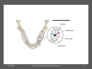10/21/2019 Dr.Sherif sultan,BDS,MSc,PhD,Fixed prosthodontics 50
 