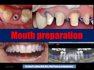 Mouth preparation
10/21/2019 Dr.Sherif sultan,BDS,MSc,PhD,Fixed prosthodontics 1
 