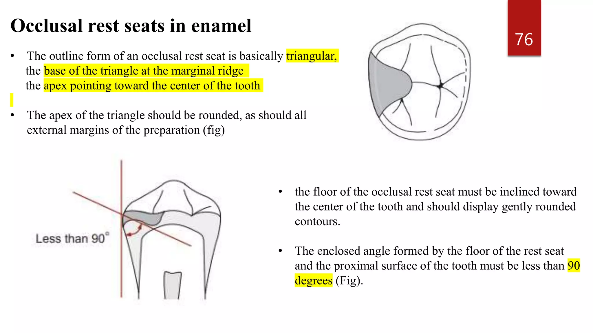 Marginal Ridge Rests MOUTH PREPARATION FOR REMOVABLE PARTIAL DENTURES.pptx
