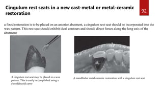 MOUTH PREPARATION FOR REMOVABLE PARTIAL DENTURES.pptx