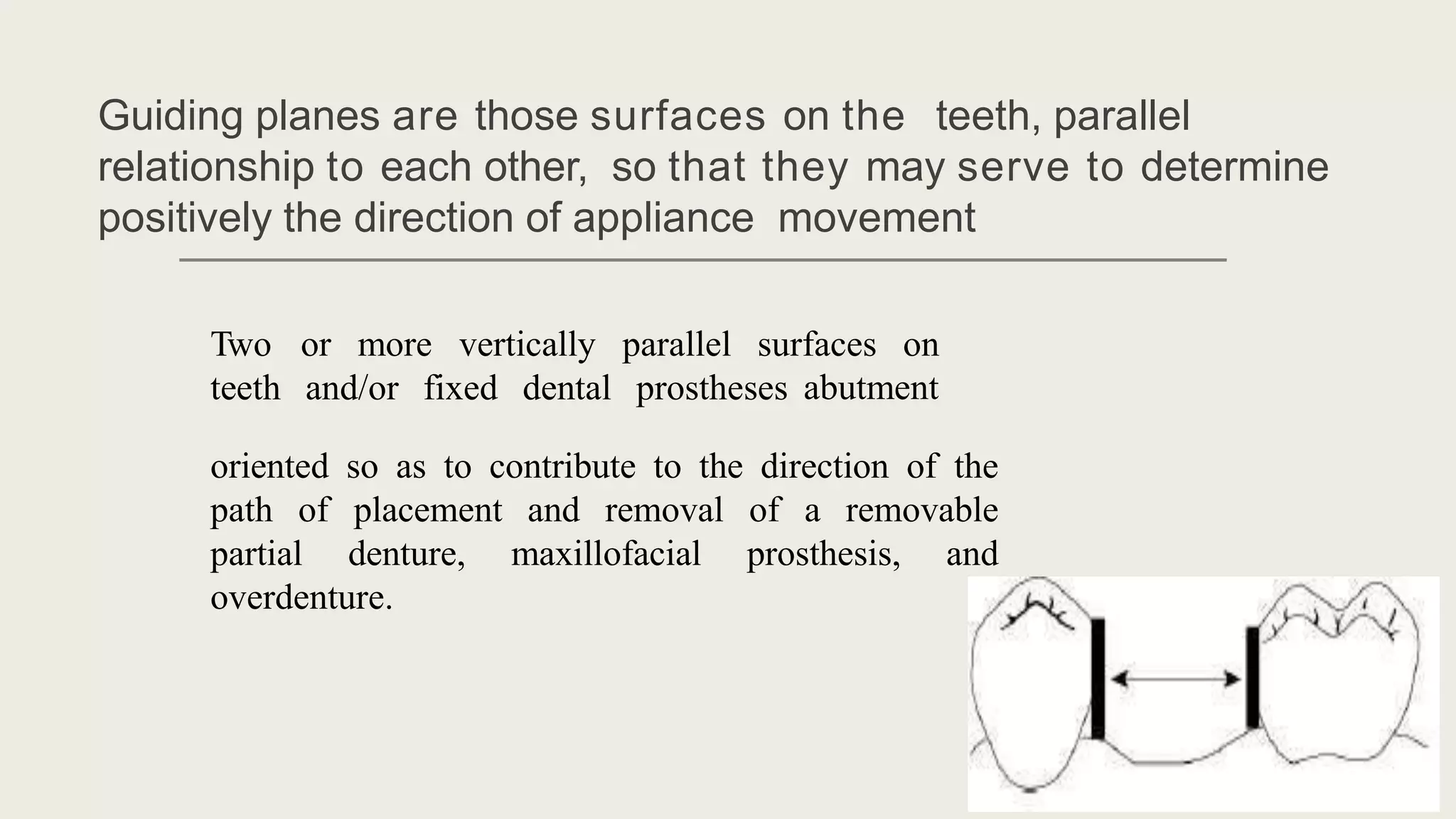 Mouth Preparation For Removable Partial Dentures.pptx