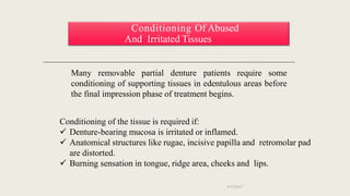 Mouth Preparation For Removable Partial Dentures.pptx