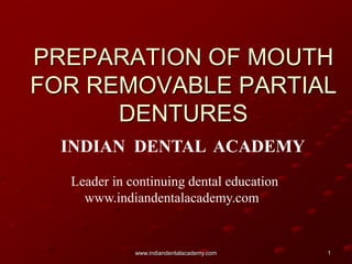 PREPARATION OF MOUTH
FOR REMOVABLE PARTIAL
DENTURES
INDIAN DENTAL ACADEMY
Leader in continuing dental education
www.indiandentalacademy.com

www.indiandentalacademy.com

1

 