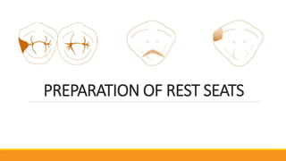PREPARATION OF REST SEATS
 