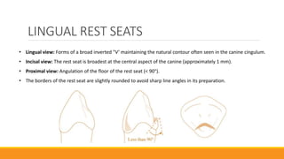 LINGUAL REST SEATS
• Lingual view: Forms of a broad inverted "V’ maintaining the natural contour often seen in the canine cingulum.
• Incisal view: The rest seat is broadest at the central aspect of the canine (approximately 1 mm).
• Proximal view: Angulation of the floor of the rest seat (< 90°).
• The borders of the rest seat are slightly rounded to avoid sharp line angles in its preparation.
 