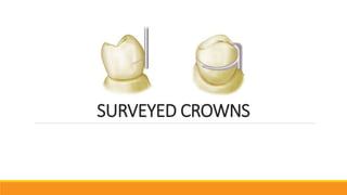 SURVEYED CROWNS
 