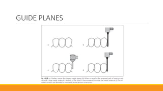 GUIDE PLANES
 