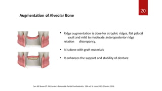 Removable Ridges Comprehensive Mouth Preparation Techniques for Removable Partial ...
