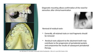Retained Roots's Extraction Comprehensive Mouth Preparation Techniques for Removable Partial ...