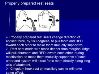 Direct Rpd mouth prepration in rpd.ppt