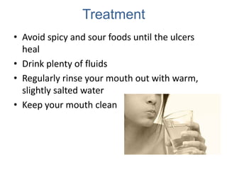 Treatment
• Avoid spicy and sour foods until the ulcers
  heal
• Drink plenty of fluids
• Regularly rinse your mouth out with warm,
  slightly salted water
• Keep your mouth clean
 