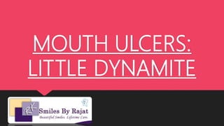 MOUTH ULCERS:
LITTLE DYNAMITE
 